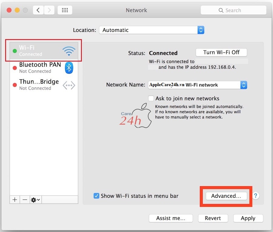 Đổi DNS network Macbook