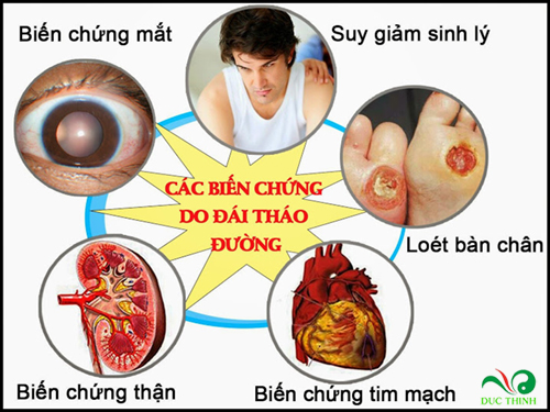 day thia canh tri tieu duong