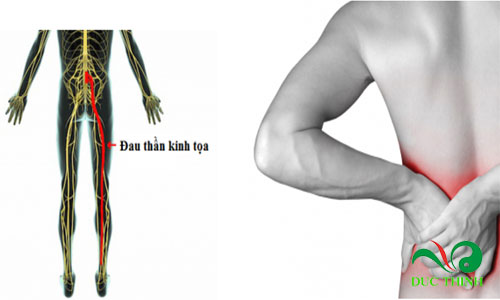 tac dung cua cay khuc khac 2