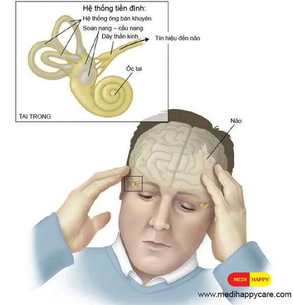 Rối loạn tiền đình
