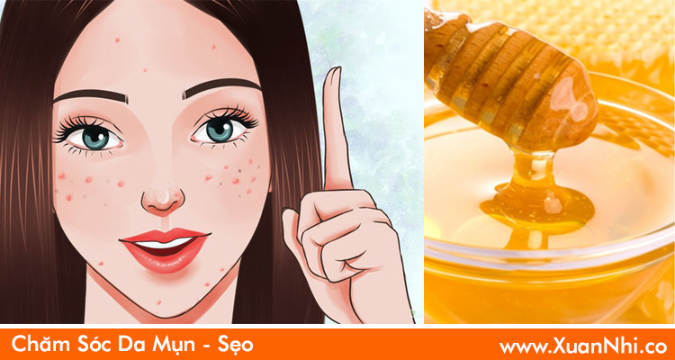 khac-phuc-mun-va-vet-tham