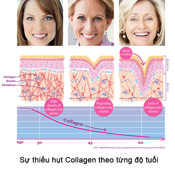 thieu-hut-collagen-theo-tuoi