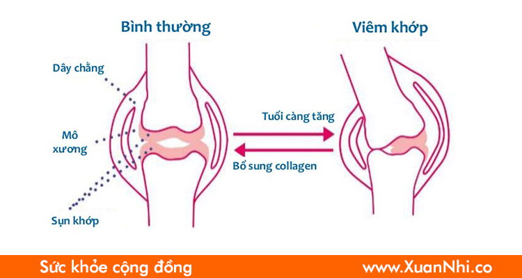 bo-sung-collagen-type-2