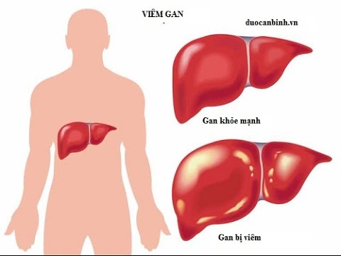viem-gan