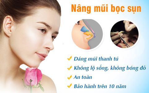 nâng mũi bọc sụn