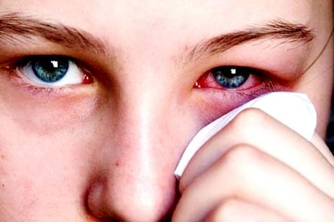 Đeo kính mát bị nhức mắt - Kính mát hàng hiệu Abama
