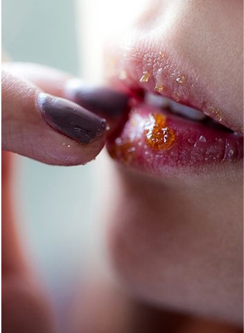 Cách trị môi khô hiệu quả bằng đường