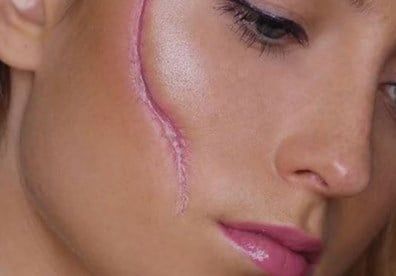 Cách vẽ mặt sẹo đơn giản không mất thời gian đi chơi halloween