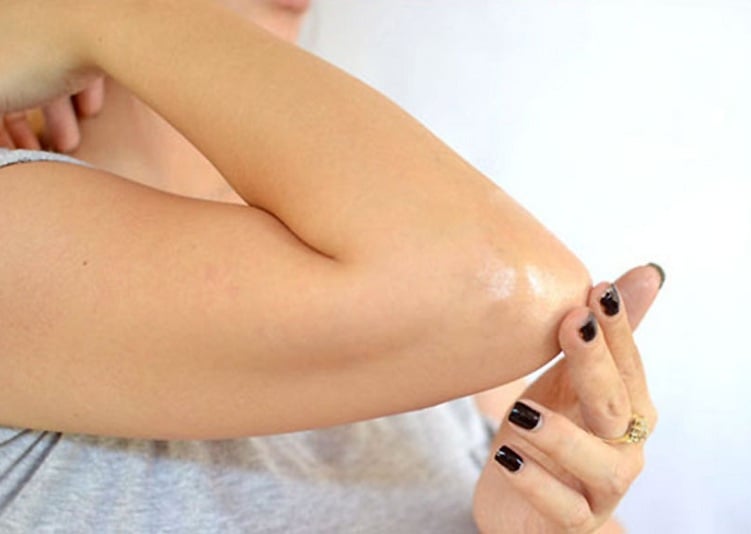 Cách loại bỏ da khô sần sùi ở khuỷu tay trong tích tắc